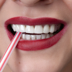 Какие проблемы можно решить с помощью виниров